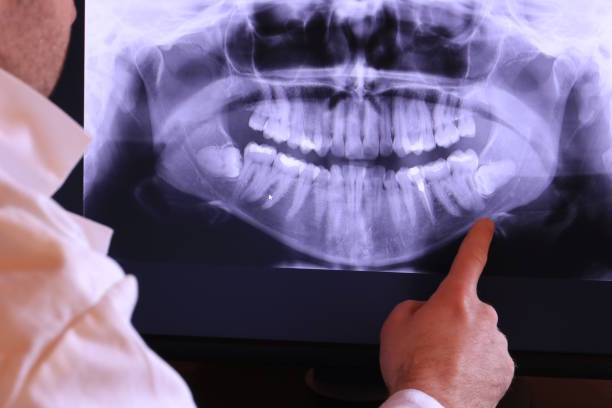 Best Emergency Denture Repair in Stewart Manor, NY
